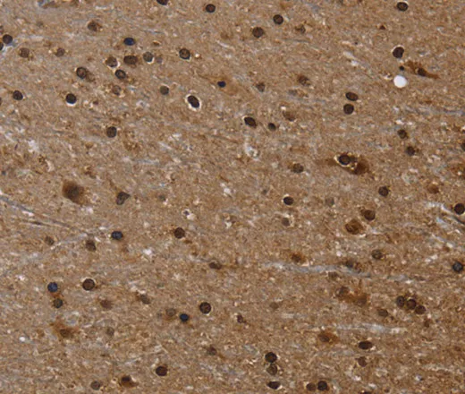 FLNA Polyclonal Antibody - image 2