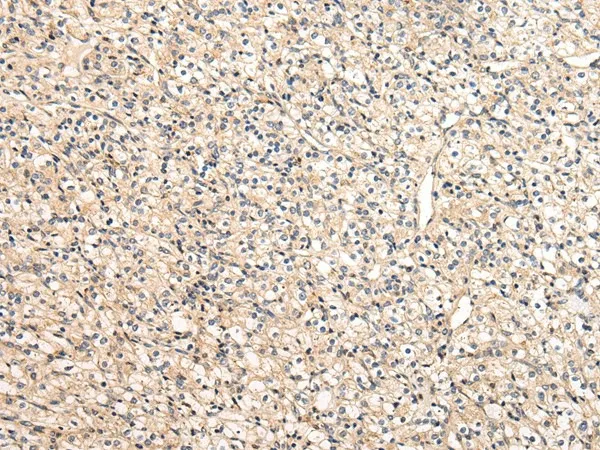 VPS33B Polyclonal Antibody - image 1