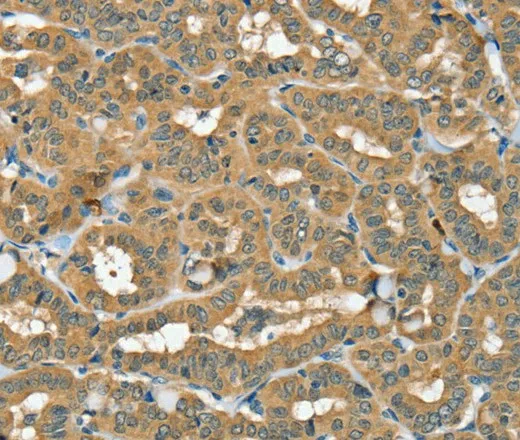 SEC14L2 Polyclonal Antibody - image 2