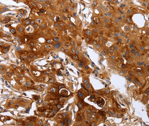 PLAUR Polyclonal Antibody - image 1