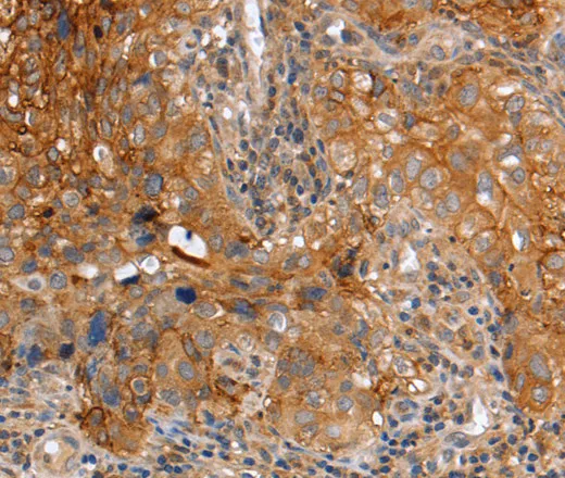 PLAUR Polyclonal Antibody - image 2