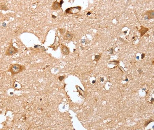 CAPG Polyclonal Antibody - image 1