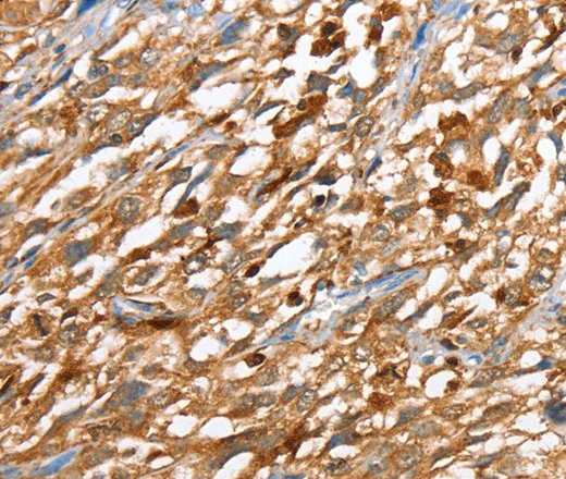 CAPG Polyclonal Antibody - image 2