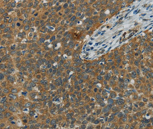 E2F6 Polyclonal Antibody - image 1