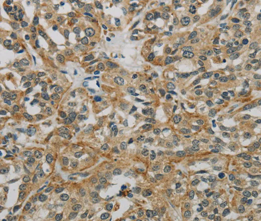 E2F6 Polyclonal Antibody - image 2