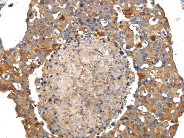 IRS2 Polyclonal Antibody - image 1