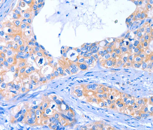 ARRB1 Polyclonal Antibody - image 1