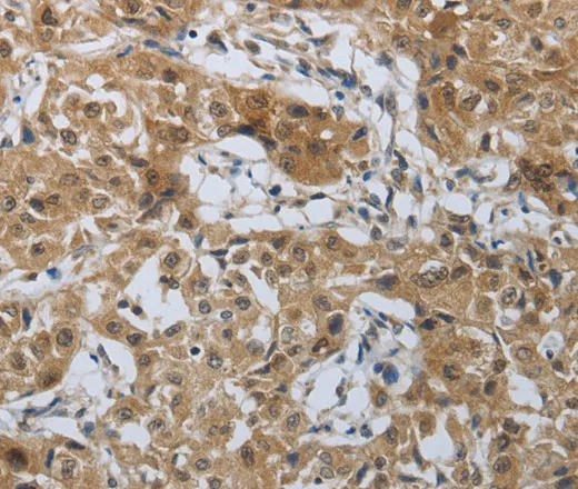 PTPRM Polyclonal Antibody - image 1