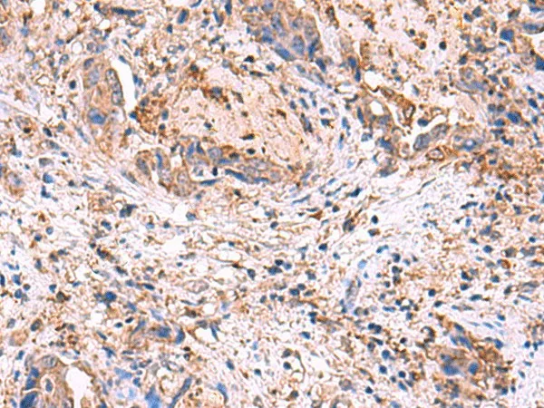 MPP1 Polyclonal Antibody - image 1