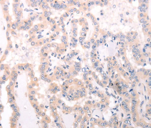 TRAF3IP1 Polyclonal Antibody - image 1