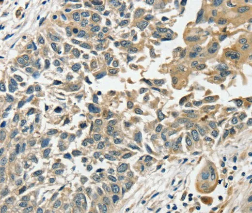 SLC8A3 Polyclonal Antibody - image 1