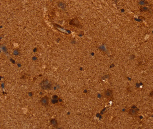 ALG11 Polyclonal Antibody - image 1