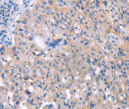 AP1B1 Polyclonal Antibody - image 1