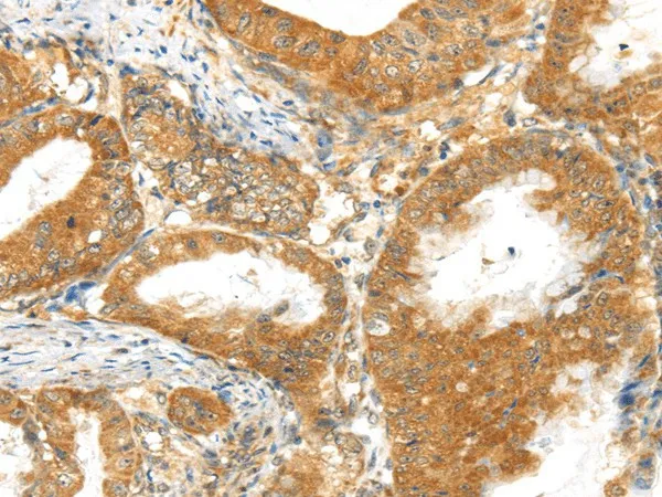 MPP6 Polyclonal Antibody - image 1