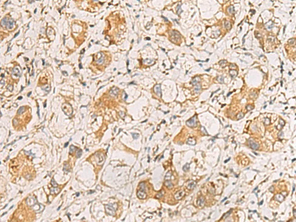 RAB38 Polyclonal Antibody - image 1