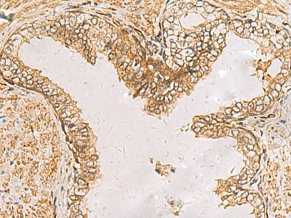 RAB38 Polyclonal Antibody - image 2