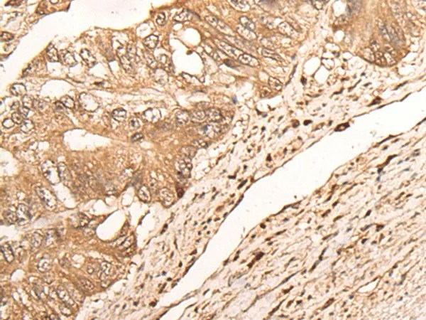MAGEA1 Polyclonal Antibody - image 1