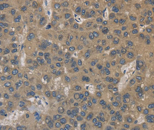 EMC8 Polyclonal Antibody - image 1