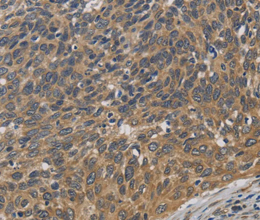 EMC8 Polyclonal Antibody - image 2