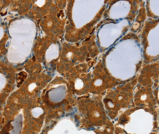 RAB27A Polyclonal Antibody - image 1