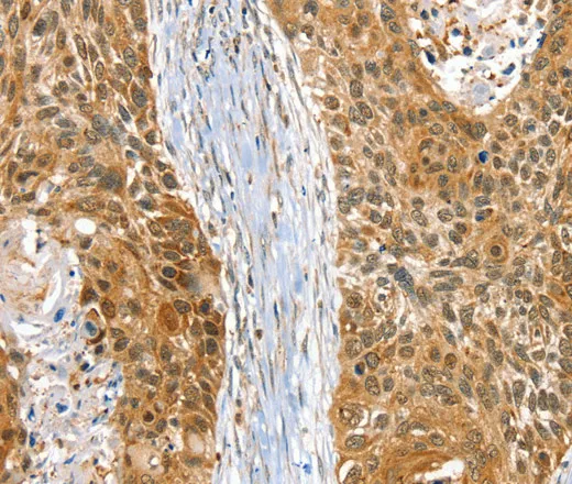 RAB27A Polyclonal Antibody - image 2