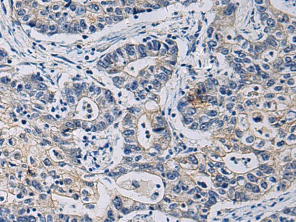 CHST3 Polyclonal Antibody - image 1