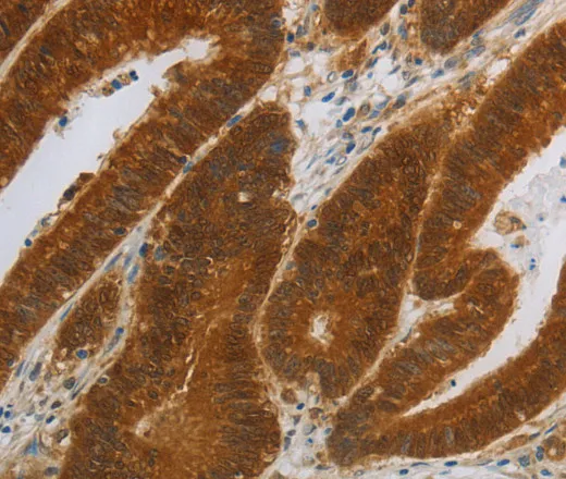 NIT2 Polyclonal Antibody - image 1