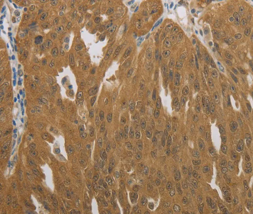 NIT2 Polyclonal Antibody - image 2