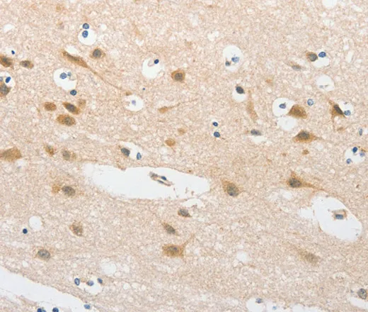 TLR5 Polyclonal Antibody - image 1