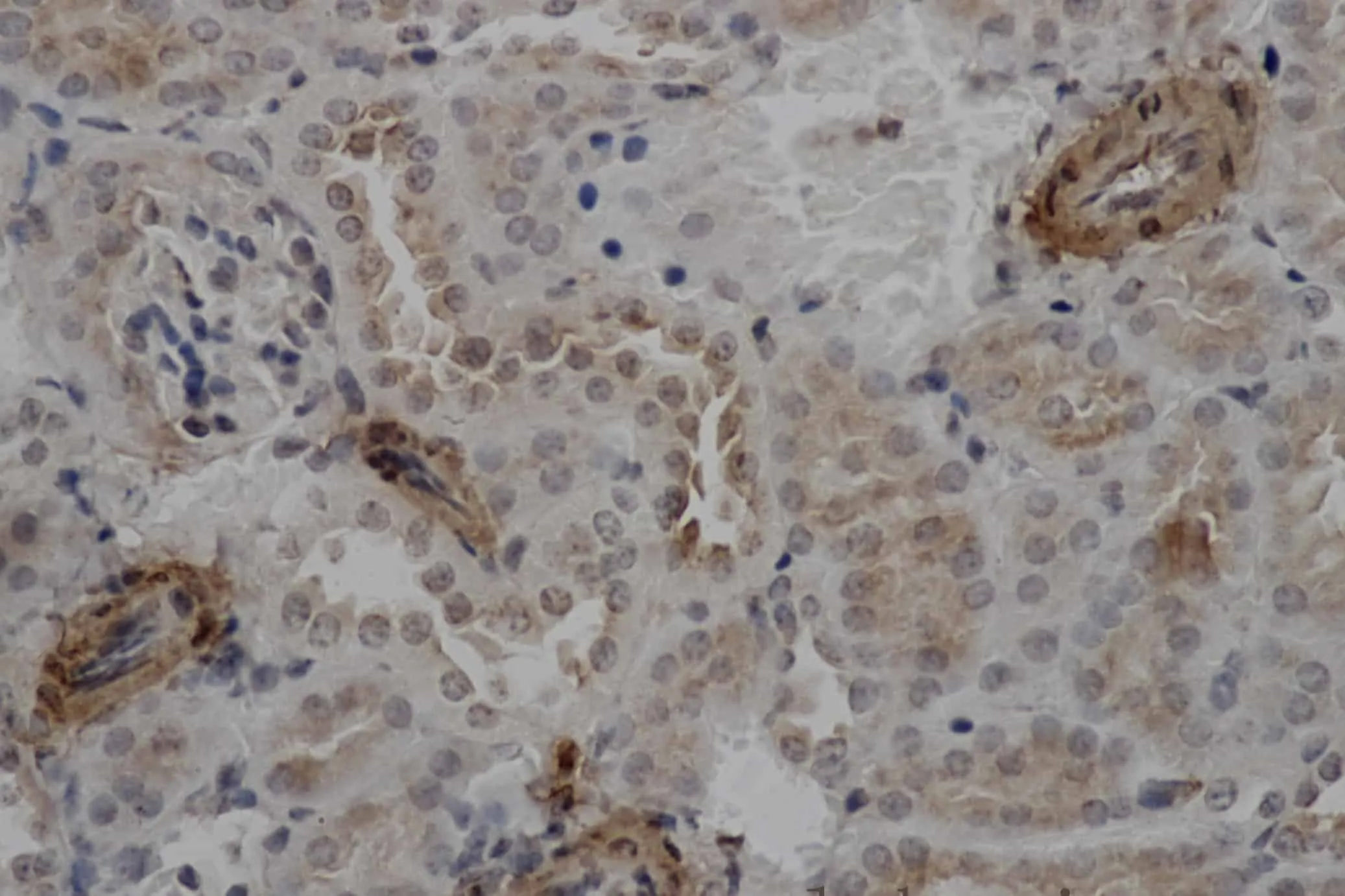 ACTA2 Polyclonal Antibody - image 1