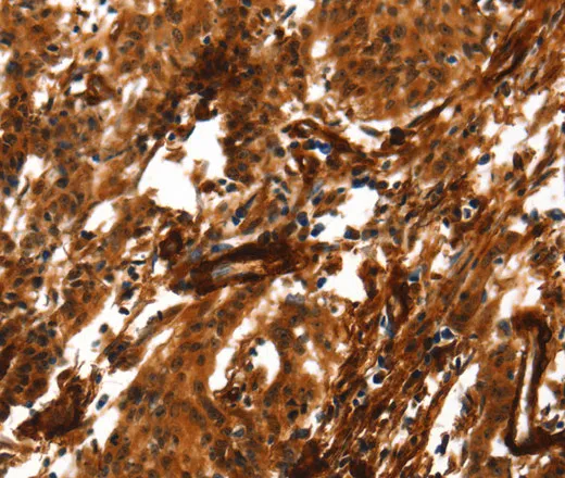 ACTA2 Polyclonal Antibody - image 2