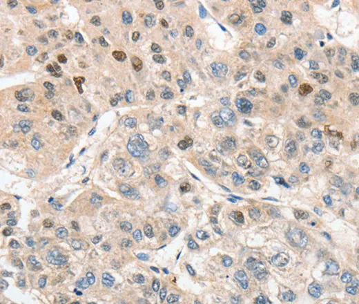 APC5 Polyclonal Antibody - image 1