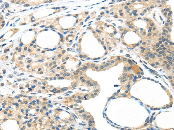 MASP2 Polyclonal Antibody - image 1