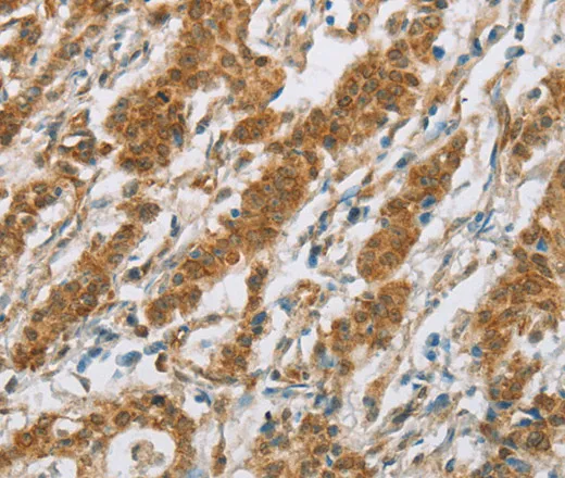CYP2E1 Polyclonal Antibody - image 2