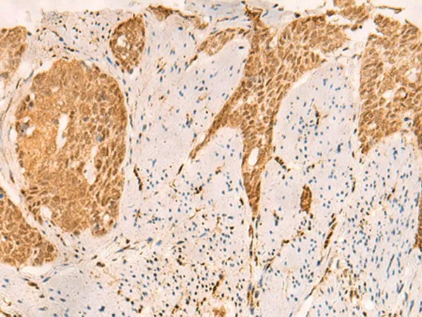 SETD1A Polyclonal Antibody - image 1