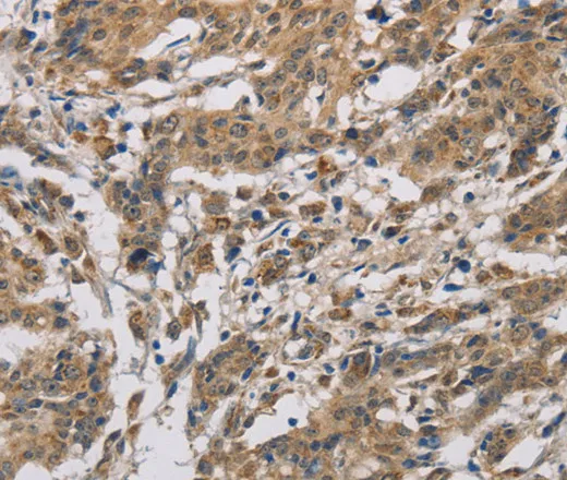 CYCS Polyclonal Antibody - image 2