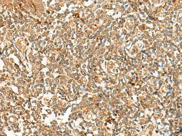POLR1E Polyclonal Antibody - image 1