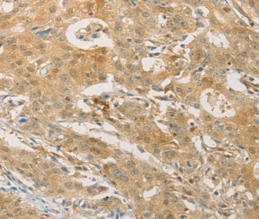 PGK2 Polyclonal Antibody - image 1