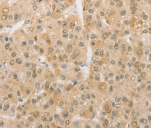 PGK2 Polyclonal Antibody - image 2
