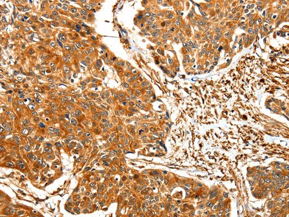 TPM2 Polyclonal Antibody - image 1