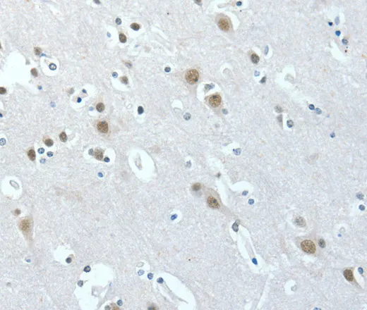 ACLY Polyclonal Antibody - image 1