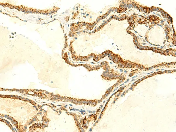 NAPRT Polyclonal Antibody - image 1