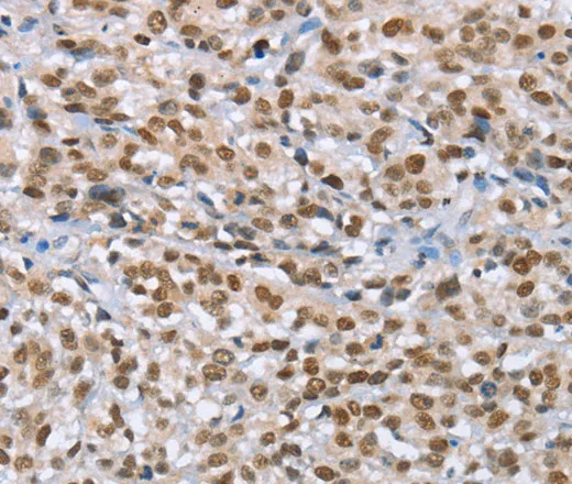 MCM6 Polyclonal Antibody - image 1
