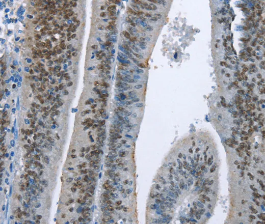 MCM6 Polyclonal Antibody - image 2