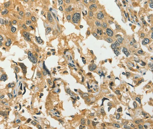 DIRAS1 Polyclonal Antibody - image 1
