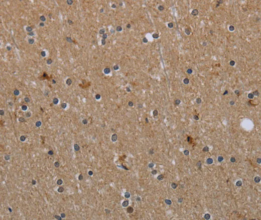 MYO7A Polyclonal Antibody - image 1