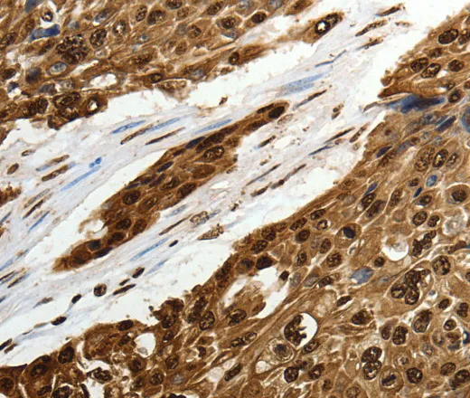 SCN1A Polyclonal Antibody - image 1