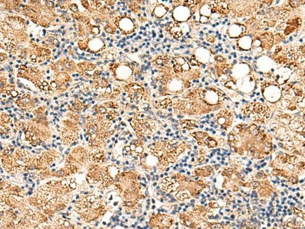 NEGR1 Polyclonal Antibody - image 1