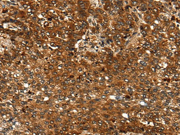 CDKL4 Polyclonal Antibody - image 1