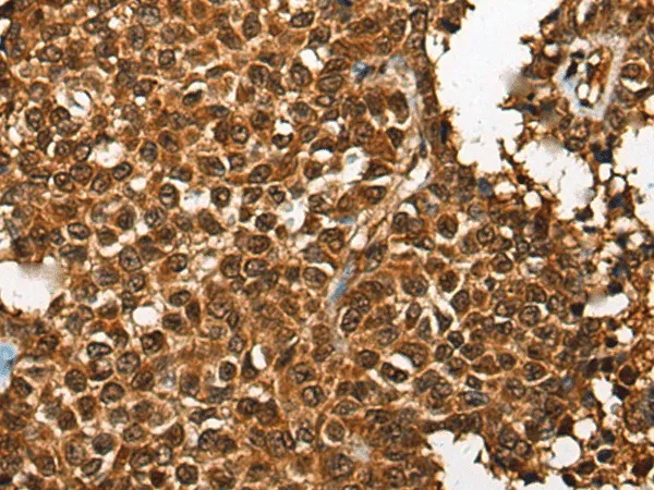 CDKL4 Polyclonal Antibody - image 2